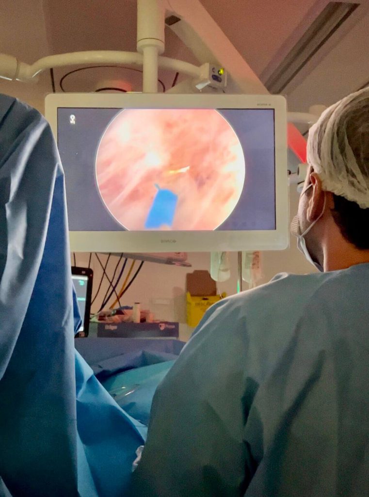 HoLEP ThuLEP próstata enucleação